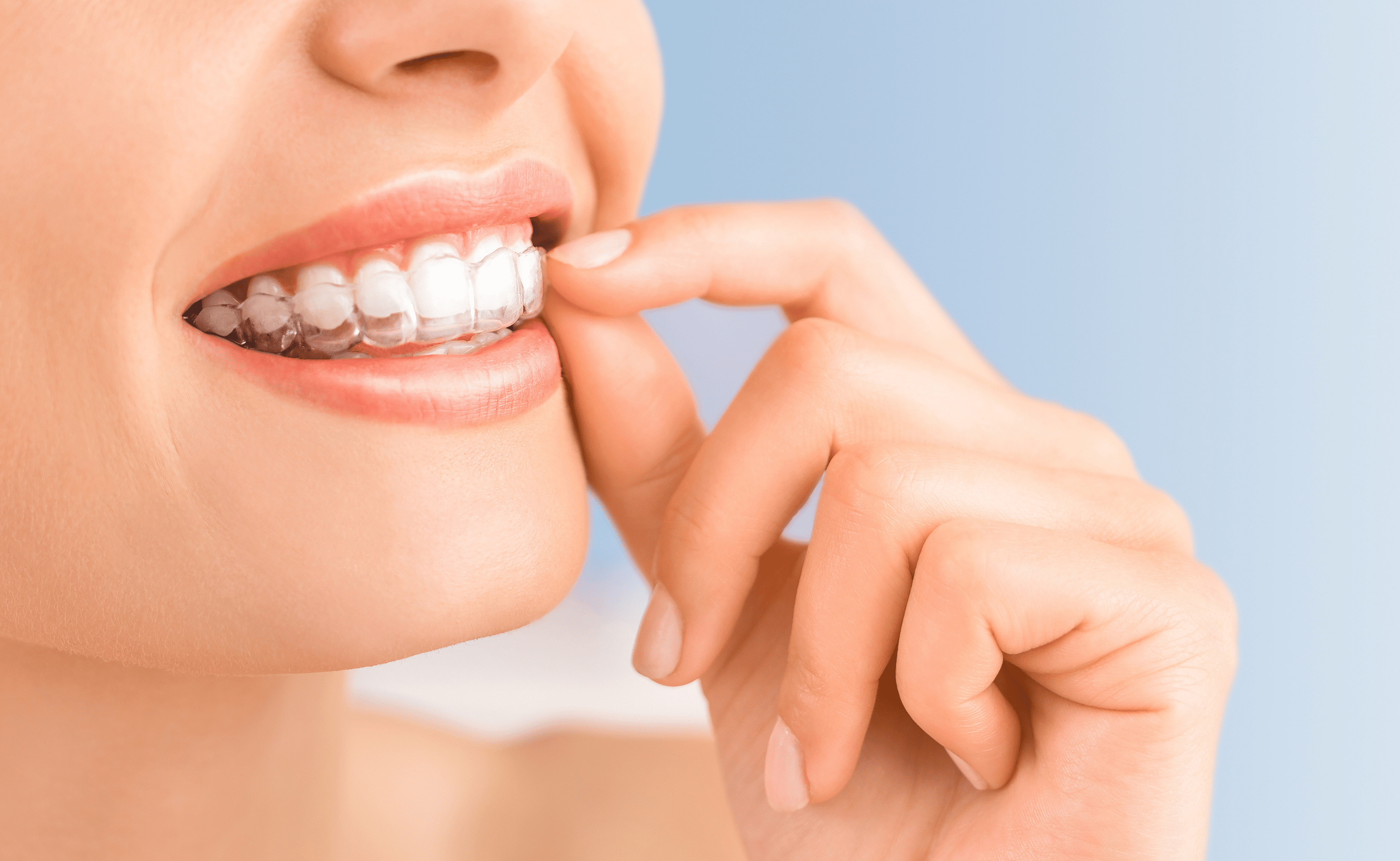 Adult Teeth Straightening